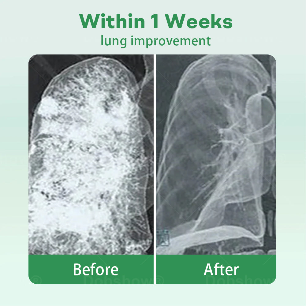 ✅Official Store| Cvreoz® Herbal Lung Cleansing Inhaier(🫁Cough, wheezing, shortness of breath, sputum, stuffy nose, bronchitis, bronchitis, allergy symptoms, lung discomfort💝)